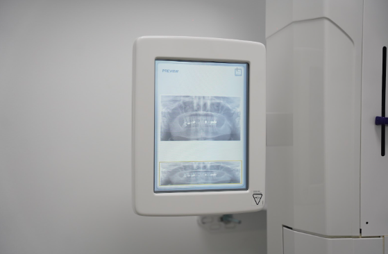 El escáner 3D como método odontológico
