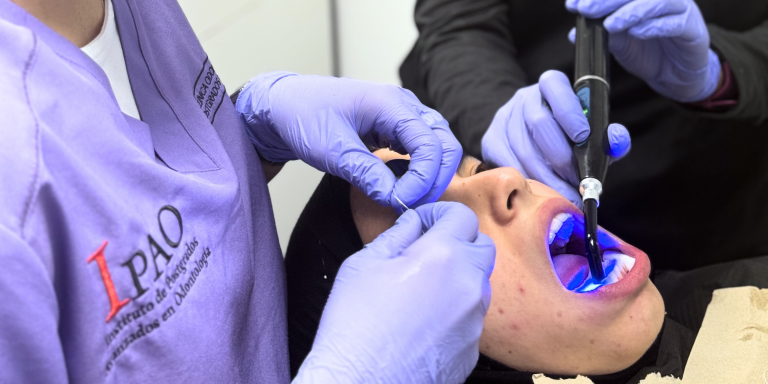 Tecnica-de-adhesion-dental-con-luz-ultravioleta-y-resina-compuesta-en-clinica-ipao